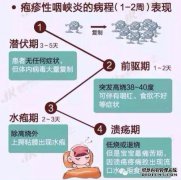咽颊的症状